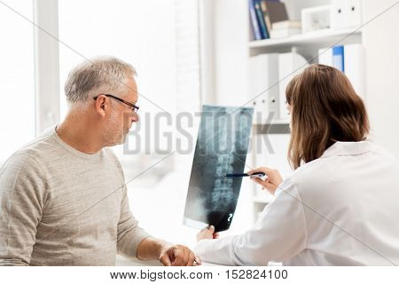 medicine, healthcare, surgery, radiology and people concept - doctor showing x-ray of spine to senior man at hospital