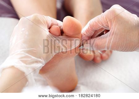 Callus on the foot.
Imprint on the foot.
The doctor removes the imprint on the foot with a scalpel Podology.
Removing the prints on the foot.
Pedicure.