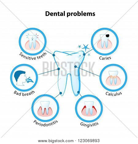 dental problem. Tooth disease: sensitive teeth caries calculus gingivitis periodontitis and bad breath