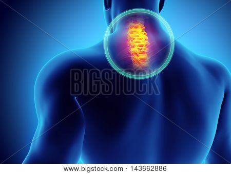 Neck Painful - Cervica Spine Skeleton X-ray, 3D Illustration.