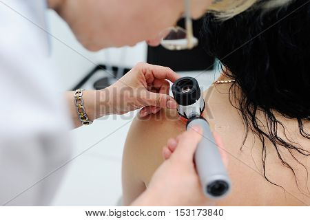 Doctor examining birthmarks and moles patient. examination of birthmarks and moles.the doctor examines the patient's mole