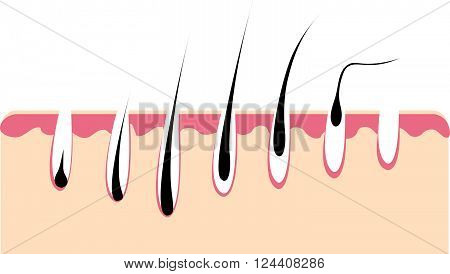 Loss hair growth hair problem health hair. Hair growth phase. Vector illustration