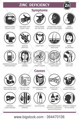 Symptoms And Causes Of Zinc Deficiency. Icon Set. Template For Use In Medical Agitation. Vector Illu