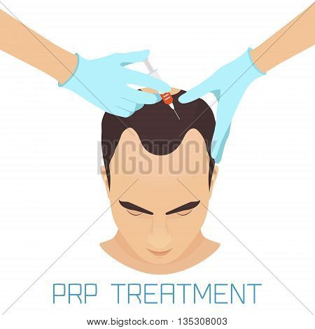 Platelet rich plasma injection procedure for men. PRP treatment process. Male hair loss treatment infographics. Meso therapy. Hair growth stimulation. Vector illustration.