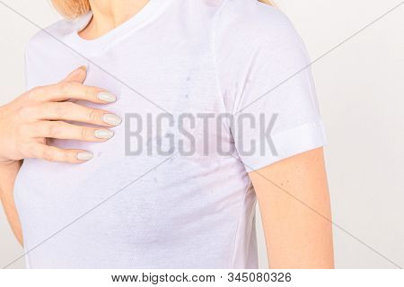 Close-up Asian Woman With Hyperhidrosis Sweating. Young Asia Woman With Sweat Stain On Her Clothes A