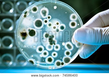  Gloved hand holding a Petri dish