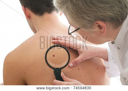 Dermatologist examines a mole of male patient