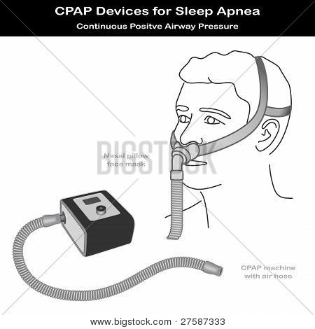 Sleep Apnea, Cpap Machine, Nasal Pillow Mask