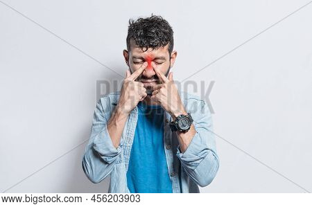 People With Pain Touching Nose. Handsome Man With Nasal Bridge Pain, Man With Nasal Bridge Headache.