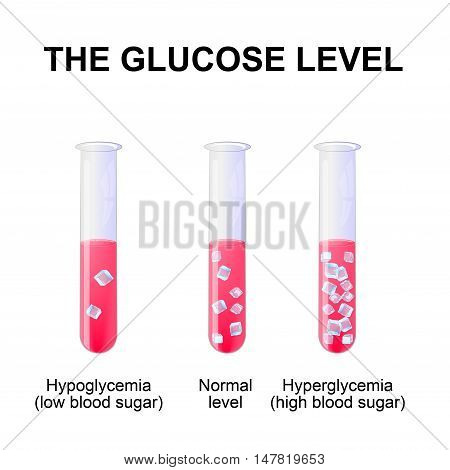 blood sugar level or glucose level. Normal level Hyperglycemia and Hypoglycemia. test-tube with blood