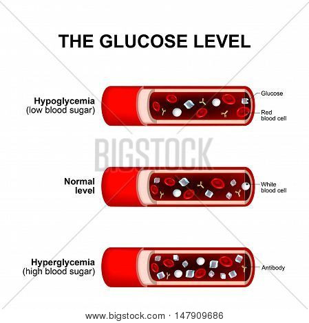 blood sugar level or glucose level. Normal level Hyperglycemia and Hypoglycemia. blood vessels with crystals of sugar (glucose ) white and red blood cells