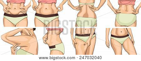 Set Women With Fat Belly. The Girl Clamps The Fold Of The Belly With Both Hands. Female Hands Touchi