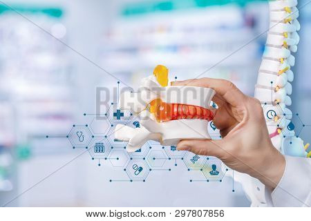 A Closeup Of Female Doctor Hand With Artificial Herniated Disc And Medical Service Structure And Spi