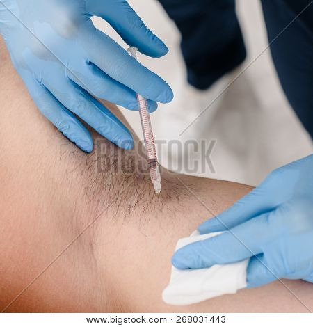 Closeup Of Female Doctor Making Injections In Armpit Against Hyperhidrosis For Man