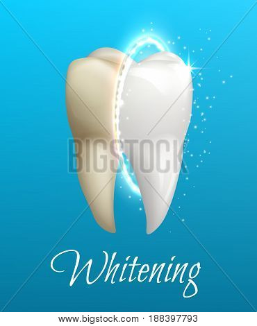 Teeth whitening 3d concept. Comparison of clean and dirty tooth before and after whitening treatment. Teeth whitening procedure, dental health and oral hygiene poster for dentistry design