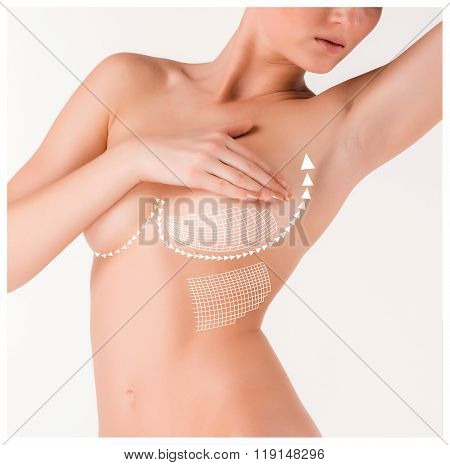 Boobs correction with help of plastic surgery on white background