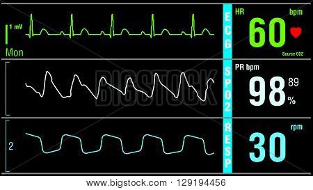 Patient monitor displays vital signs ECG electrocardiogram EKG, oxygen saturation SPO2 and respiration. Medical examination vector illustration.