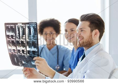 radiology, surgery, health care, people and medicine concept - group of happy doctors looking to and discussing x-ray image of spine at hospital