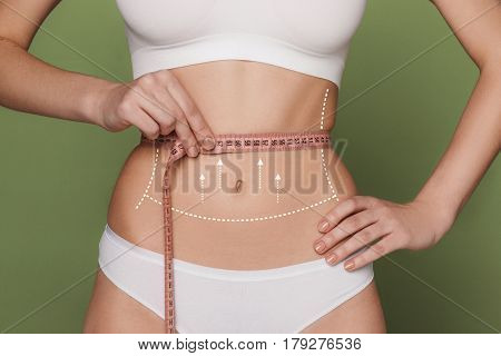 Women belly with the drawing arrows. The cellulite removal plan. White markings on young woman body preparing for plastic surgery. Concept of slimming, liposuction, strand lifting