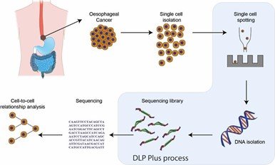 Developing Individualized Cancer Treatment — CANADA-UK FOUNDATION