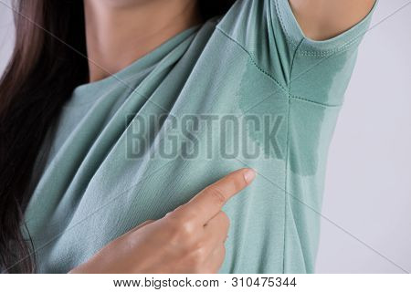 Close-up Asian Woman With Hyperhidrosis Sweating. Young Asia Woman With Sweat Stain On Her Clothes A