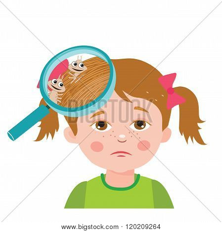 Girl With Lice. Magnifying Glass Close Up Of A Head. Vector Illustration. Dirty Head. Dirty Hair. Infection. Head Lice On The Head. Child With Lice. Mud Girl. Hygiene Promotion. Poverty Girl.