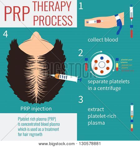 Platelet rich plasma injection. PRP therapy process. Hair loss treatment. Injection. Mesotherapy. Hair growth stimulation. Transplantation of hair.