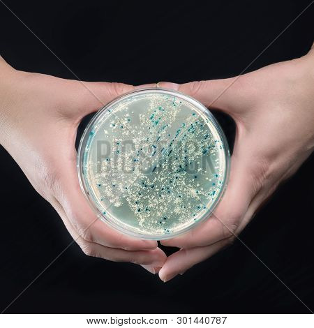 Hands Holding Agar Plate With Bacterial Colonies For Plasmid Vector Cloning