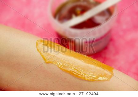 Sugaring: epilation with liquate sugar at legs. It is less painful hair removal with wax replacement