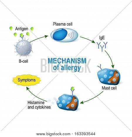 Mechanism of allergy. Mast cells and allergic reaction. B-cell is exposed to allergen plasma cells will initiate an overproduction of IgE antibodies. The IgE molecules attach themselves to mast cells. When allergen enters the body for the second time the