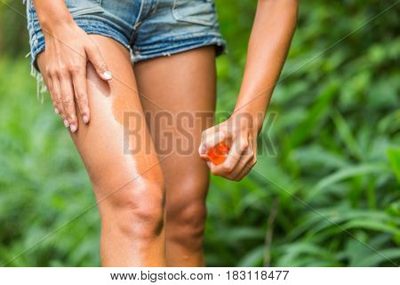 Mosquito repellent spray. Woman spraying insect repellent against bug bites, zika virus etc on legs skin outdoor in nature forest using spray bottle.