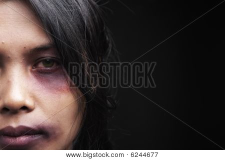 Domestic Violence Victim