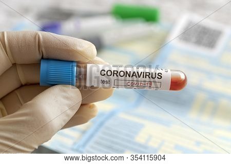 Nurse Holding A Positive Blood Test Result For The New Rapidly Spreading Coronavirus, Originating In