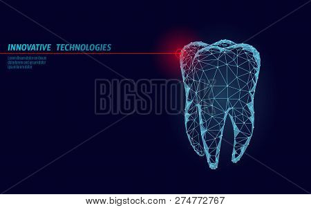 3d Tooth Innovation Laser Dentistry Polygonal Concept. Stomatology Symbol Low Poly Triangle Abstract