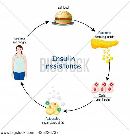 Insulin Resistance. Cycle Of Insulin And Glucose, Before And After Eat Food. Vector Illustration.