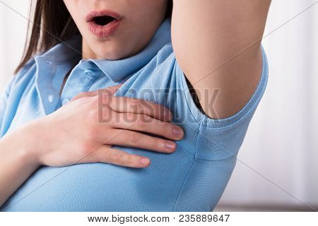 Close-up Of A Woman With Hyperhidrosis Sweating Very Badly Under Armpit