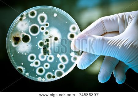  Gloved hand holding a Petri dish