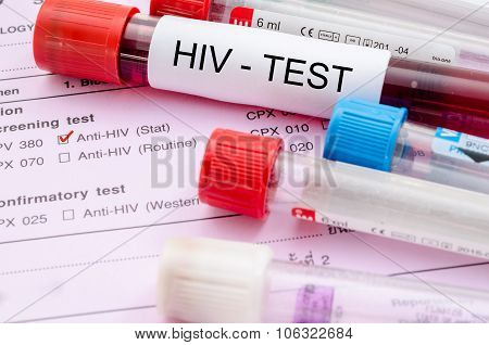 Sample Blood Collection Tube With Hiv Test Label.