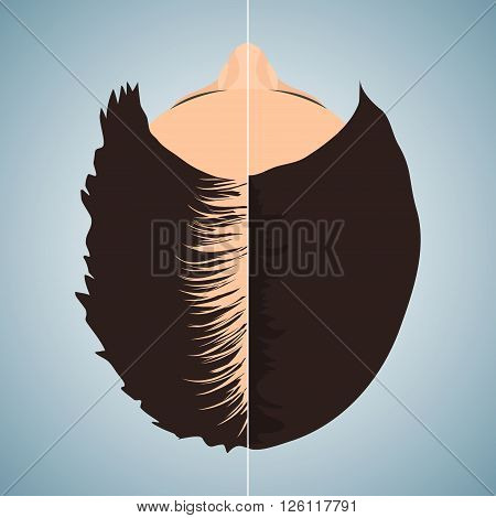 Top view portrait of a woman losing hair before and after hair treatment and hair transplantation. Divided image of a woman head. Two halves. Female hair loss. Hair care concept. Vector illustration.