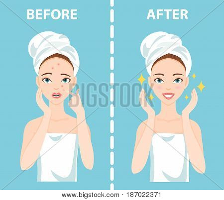 Before-After set of upset troubled and happy woman with female facial skin problems needs to care about: acne, pimples.