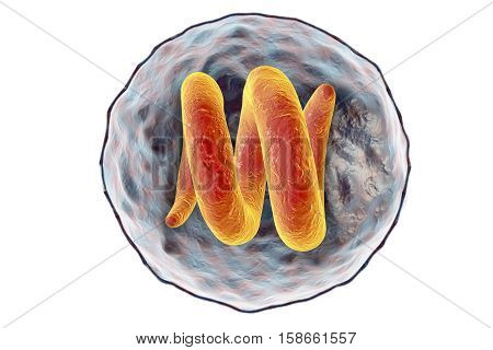 Cyst containing roundworm Trichina spiralis, formely called Trichinella spiralis, nematode larval cyst in muscle tissue, trichinosis is transmitted by ingestion of undercooked meat. 3D illustration