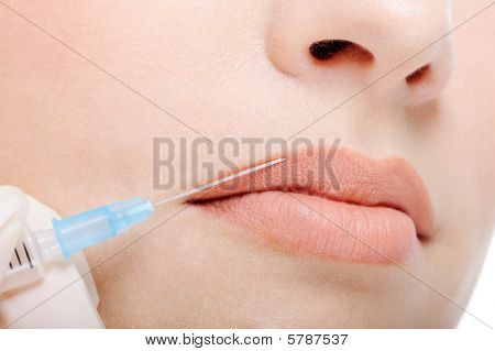 Cosmetische injectie In de vrouwelijke lippen