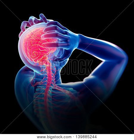 medically accurate 3d illustration of headache/ migraine