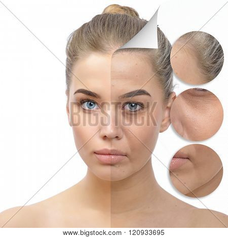 Anti-aging concept. Beautiful woman with problem and clean skin. Aging and youth concept, beauty treatment, cosmetology, lifting. Female face befor and after facial rejuvenation or plastic surgery.