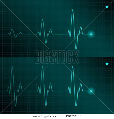 ECG izleme. Vektör.