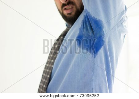 Man with Hyperhidrosis sweating very badly under armpit