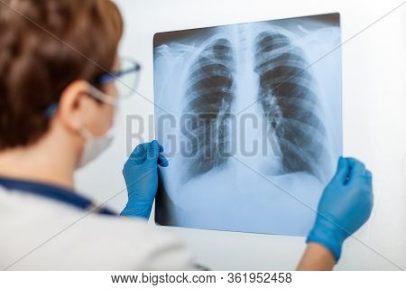 A Female Doctor Examines An X-ray Of A Patient S Lung Infected With Covid-19 Coronavirus, Pneumonia.