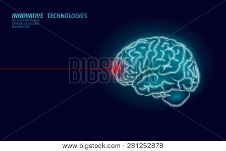 Laser Surgeon Brain Treatment Low Poly 3d Render. Drug Nootropic Human Ability Smart Mental Health. 