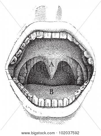 Illustration of the inside of a human mouth, vintage engraved illustration. Usual Medicine Dictionary by Dr Labarthe - 1885.