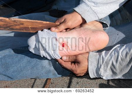 A construction worker shows a puncture wound in his foot after stepping on a nail on a construction site. Stepping on a nail hurts a lot and can cause nerve damage . time for a tetanus shot